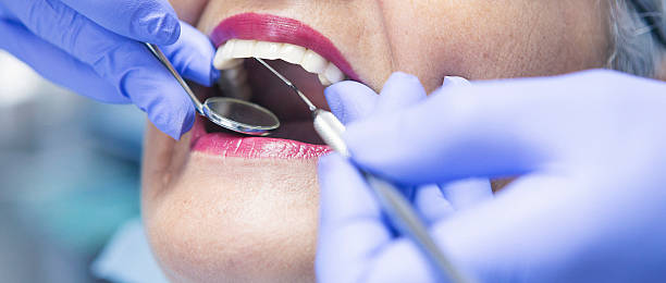 Best Emergency Dental Care for Broken or Chipped Teeth in Roselle, NJ